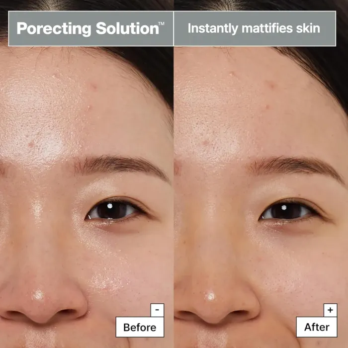 Porecting Solution