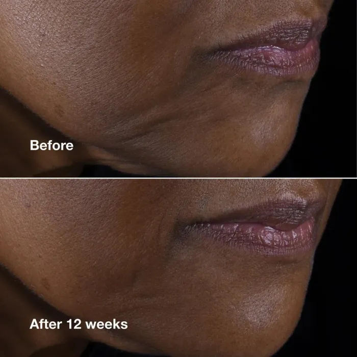 Clinique Smart Clinical Repair™ Lifting Face + Neck Cream