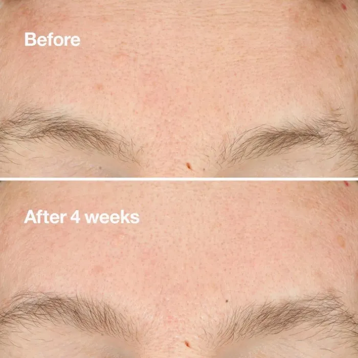 Clarifying Do-Over Peel